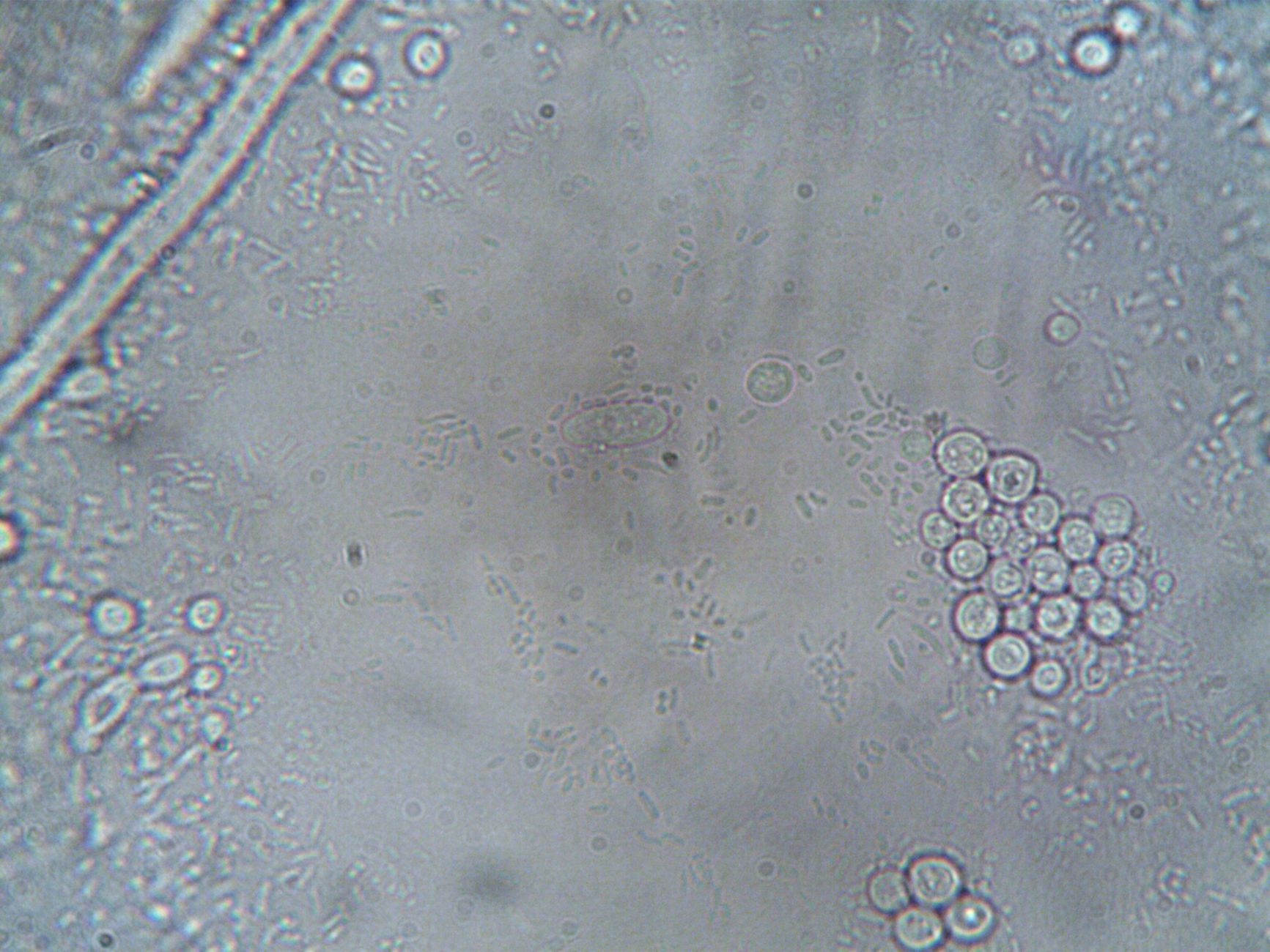 Candidose et microbiote intestinal : un équilibre fragile